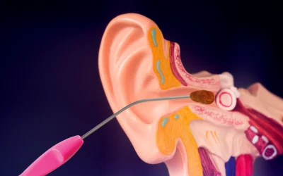 The Ultimate Guide to Microsuction Earwax Removal: Why it’s the Safest Choice